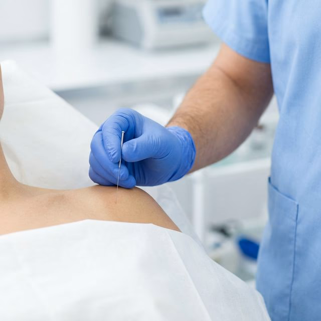 Clinical photo of ultrasound guided dry needling procedure